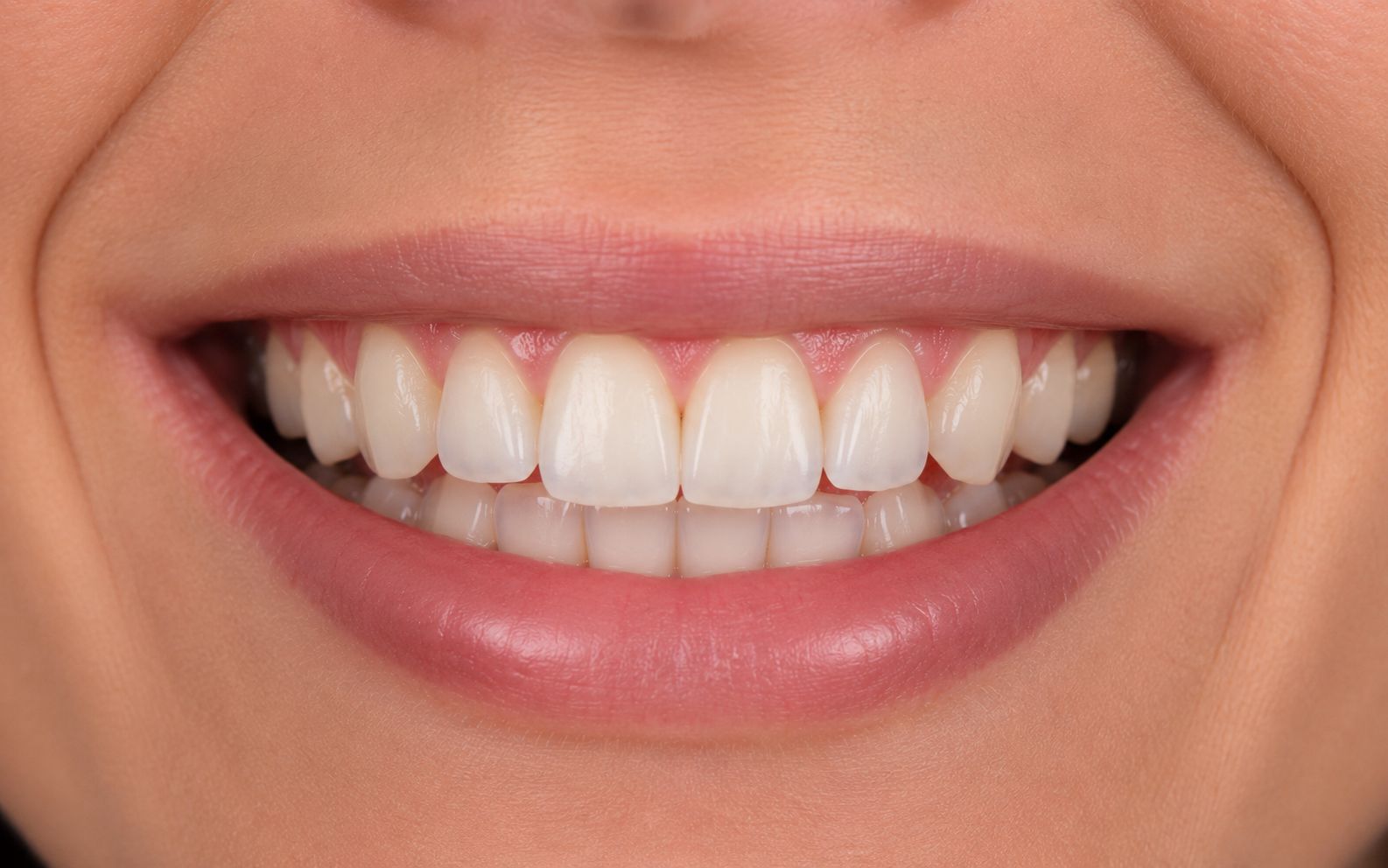 Depois do implante dentário